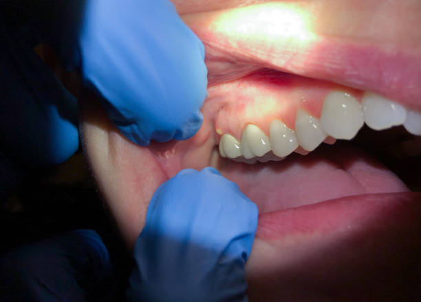 Professional Emergency Dentist in WY